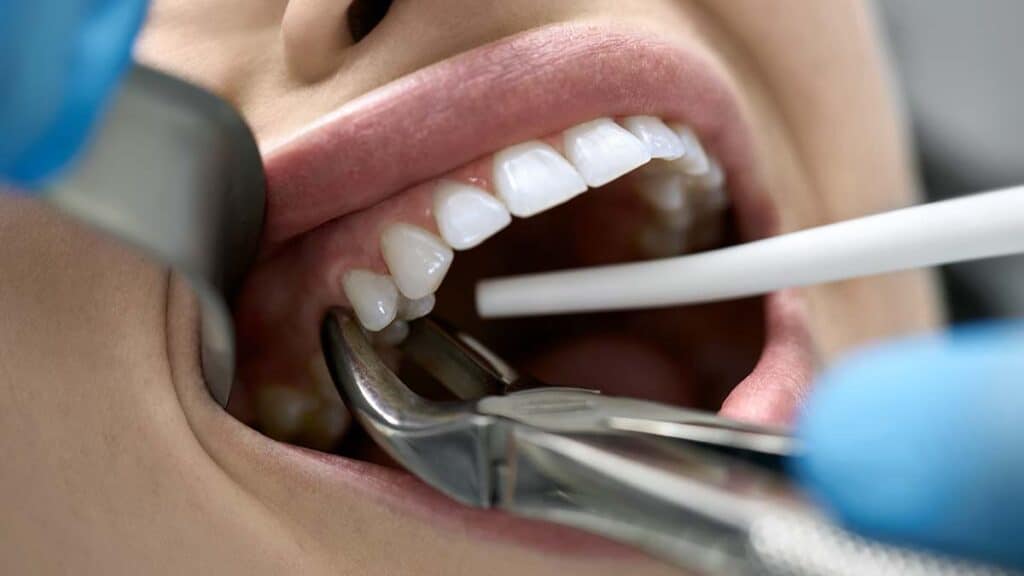 Common Dental Emergencies in Rock Hill, SC and How to Handle Them