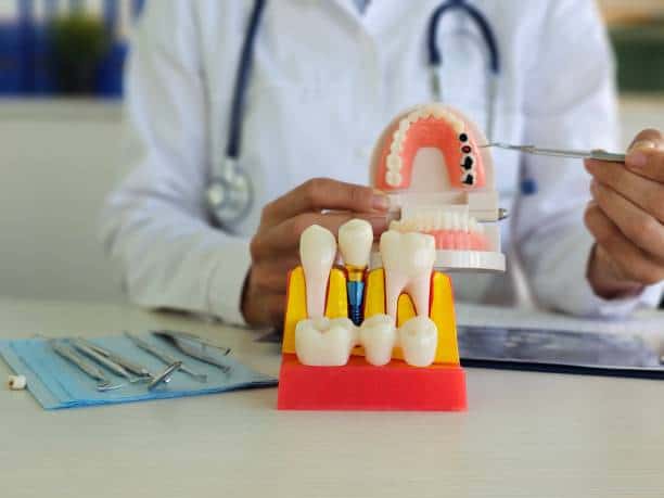 Are You a Candidate for Dental Implants in Rock Hill, SC? Expert Guide