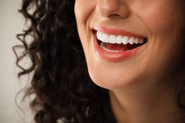 How Long Do Teeth Stay White After Whitening in Rock Hill?