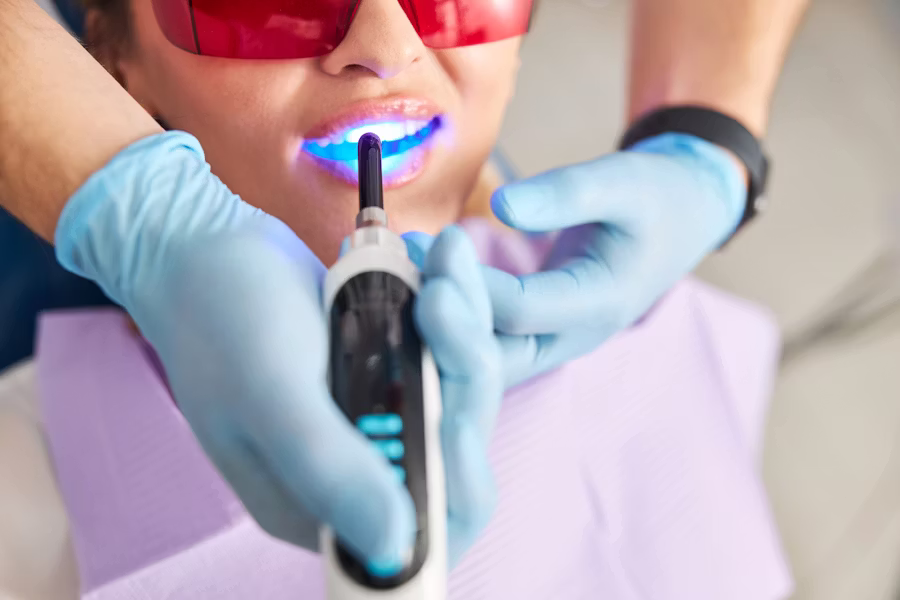 Teeth Whitening Costs in Rock Hill: What Patients Should Expect